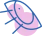 飛蚊症レーザー